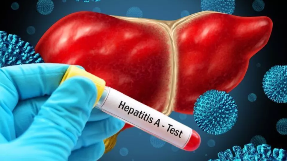 Imagen informativa sobre el incremento de casos de hepatitis A en la provincia de Pinar del Río.